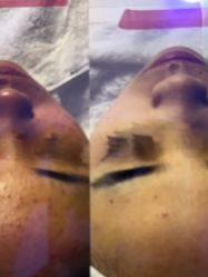 -白博士祛痘·皮肤管理中心