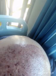 点击看大图 -新生植发·植养护一体