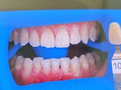 -极光口腔·矫正种植修复(锦江院区)