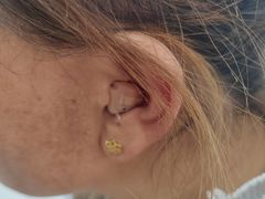 -惠耳听力助听器(信阳中山南路店)