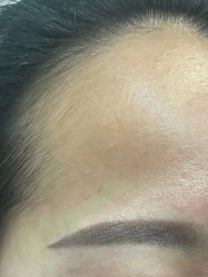 -郡艺医疗美容·微整·眼鼻吸脂