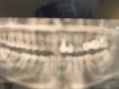 -土豆口腔(凤凰北总店)