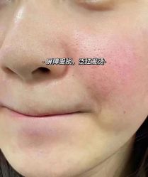 -美肤盾祛痘·问题肌头疗管理中心