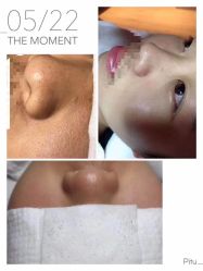 -苑苑vbeauty科技美容SPA