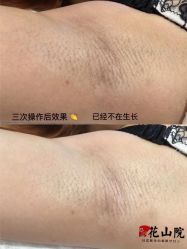 -觅屿日式脱毛美肤