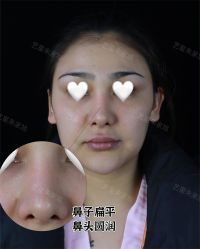 -Yestar重庆艺星医疗美容医院