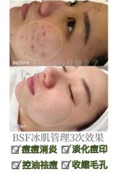 -E.beauty驻颜·痘敏肌调理中心