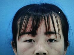 体验前-西安壹加壹医疗美容·西北抗衰旗舰店