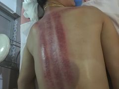 -益友堂盲人推拿正骨穴位按摩工作室