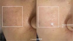 -E.beauty驻颜·痘敏肌调理中心