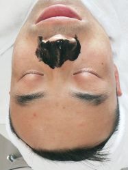 -痘博士北京·全国连锁祛痘机构