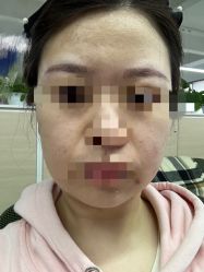 体验前-北京米扬丽格医疗美容·联合丽格鼻整形中心