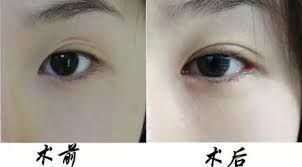 -SKINIST丽铂医疗美容