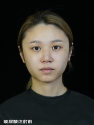-Yestar重庆艺星医疗美容医院