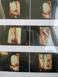 -杭州贝瑞斯美华妇儿医院·早孕·产检·儿科