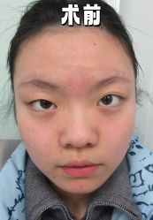 -素美医疗美容·西南眼鼻整形·修复基地