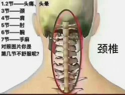 -香薇妮丝女子减肥院