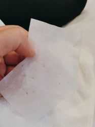 -塑青春&伊肤泉祛痘皮肤管理