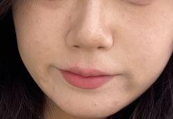 -Yestar 嘉兴艺星医疗美容医院