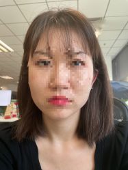 -北京米扬丽格医疗美容·联合丽格鼻整形中心