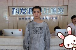 -大麦微针植发丨全国连锁