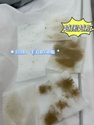 -skin79皮肤管理中心