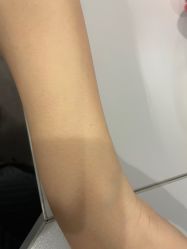 -小忠丽格医美