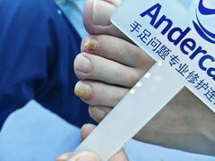 -Andrew指甲专科灰指甲·甲沟炎矫正·3D步态矫形鞋垫定制(浦三路店)