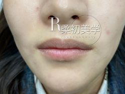 -RC半永久纹眉纹发际线