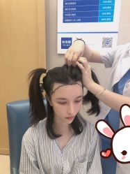 点击看大图 -大麦微针植发丨全国连锁