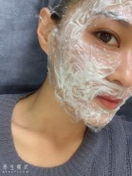 体验前-天津健丽·去眼袋医疗美容机构
