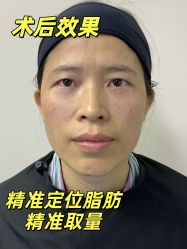 -广州健丽·去眼袋医疗美容机构