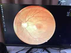 -宝岛眼镜(苏州浒关店)