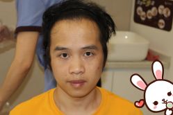 -大麦微针植发丨全国连锁