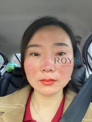 -ROYEA茹彦祛痘·问题肌肤修护中心