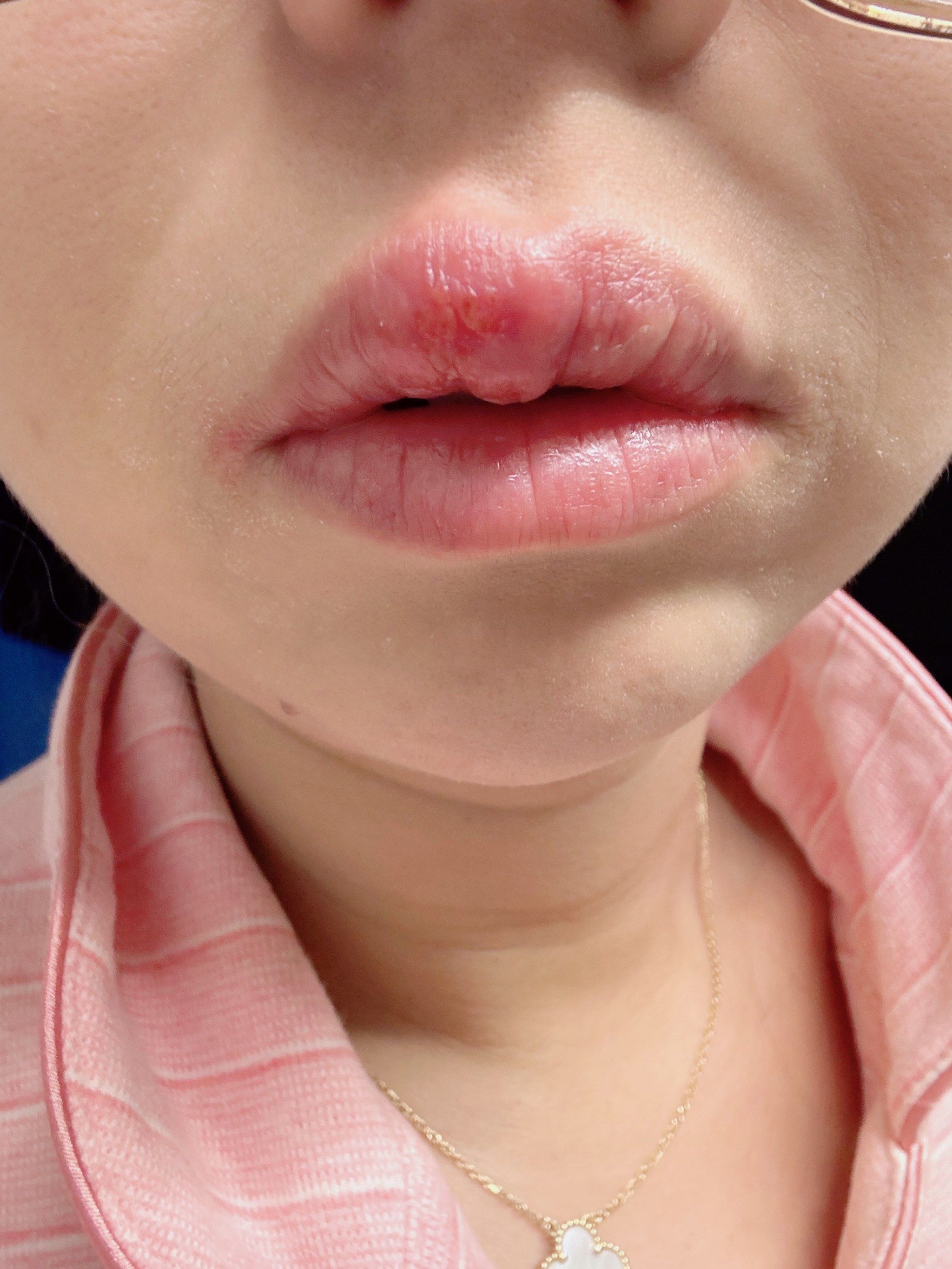 一张嘴毁了一张脸