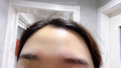 体验后-上海玫瑰医疗美容医院