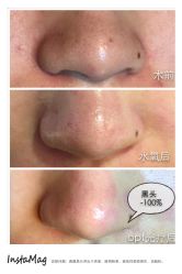 脸部抗衰-光SPA科技美肤