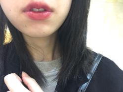 点击看大图 -禾美嘉医疗美容