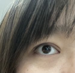 -天津健丽·去眼袋医疗美容机构