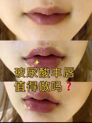 -广州美莱医疗美容医院