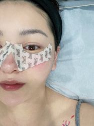 点击看大图 体验后-洁铭新加坡医美