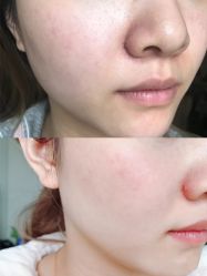 -素妍印象Ekrin Medi Clinic