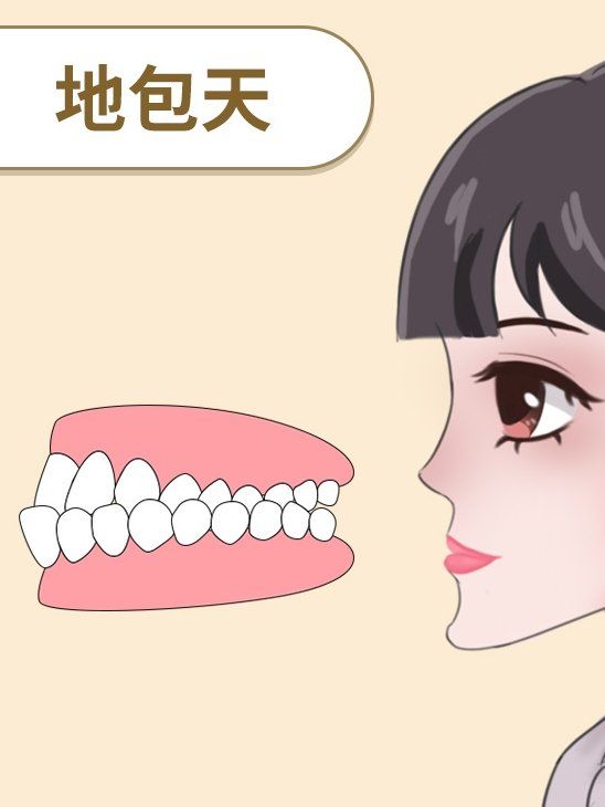 除了影响美观,地包天还对身体有什么影响
