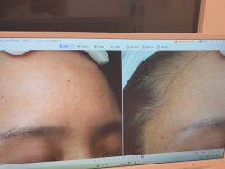 点击看大图 -苑苑vbeauty科技美容SPA