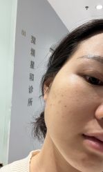 体验后-星和深湾荟医疗美容