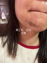 -圣嘉新医疗美容医院