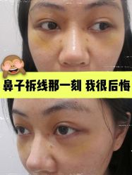 -素美医疗美容·西南眼鼻整形·修复基地