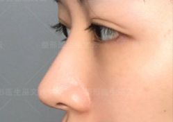 -北京米扬丽格医疗美容·联合丽格鼻整形中心