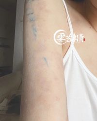 -雲艺刺青·洗纹身